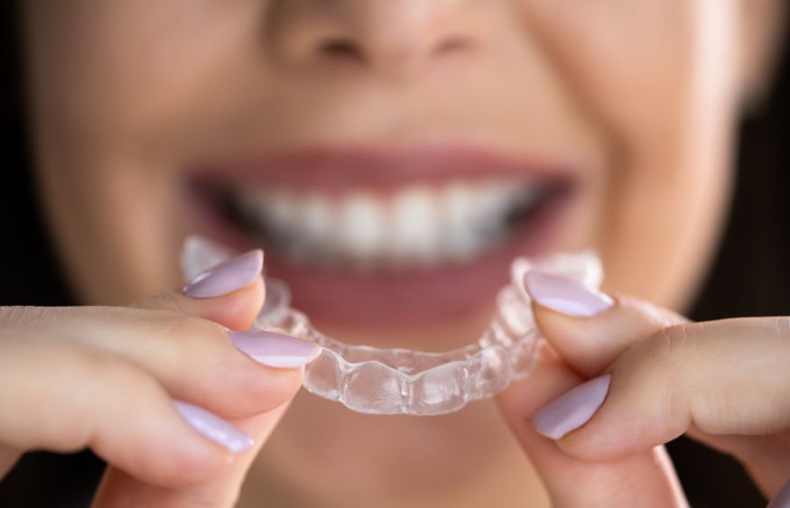 Dental Aligner for Teen